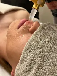 メンズヒゲ脱毛