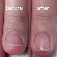 自爪育成／お試し価格[ミニオイル付き]