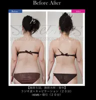 Secret Mesで全身シェイプ!全身スリムコース120分 メンズOK‼︎