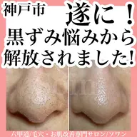 【minimo限定】初来店の方・毛穴エクストラクション黒ずみ一発綺麗コース