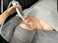 【サーマトリックス全顔💎】首​〜​全顔照射💆‍♀️毛穴の開き、ニキビ跡のクレーター、小顔ケア✨ダウンタイムなし🌷