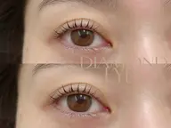 🐣平日15時まで限定🐣セラムパックつき💚選べるラッシュリフト（まつげパーマ）¥7,920→¥5,720