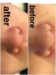 【口コミ必須】毛穴洗浄お試し体験！どのメニューを選べばいいかわからない・まずは体験してから決めたい方へ