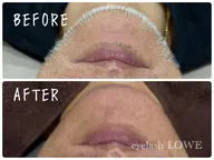 【光り輝くツヤ肌✨】メンズフェイシャルワックス（全顔）👩✨古い角質や産毛を除去してツルスベお肌に🫧