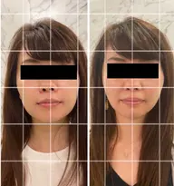 フェイシャル60分