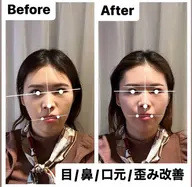 【頭蓋骨/小顔矯正】眉位置/目元/口元/お顔の歪みコース