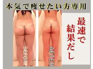 【全身痩身🌻/平日限定】🍉夏までに🔥体型を変える💎気になる全身まるごと全身痩身90分🍉