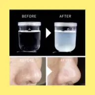 【気になる黒ずみ除去🫧】ごっそり毛穴洗浄♪ハイドロフェイシャル✨