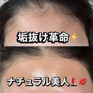 【眉×おでこ】１番人気❤️‍🔥眉毛デザイン×おでこワックス❤️‍🔥眉毛も！おでこも！