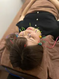 電気美容鍼⚡︎❤️