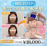 【毛穴洗浄×韓国水光肌】ピーチリフト＋水光アクア＋白玉酸素 通常¥25,300→¥18,000