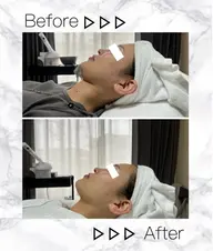 乾燥・ごわつき撃退フェイシャル