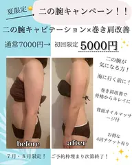 夏限定☀️二の腕キャビテーション×背中オイルハンド×巻き肩