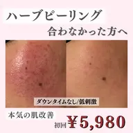 【人気No.1】脱・ハーブピーリング！！痛くないミネラルイオン艶肌✨