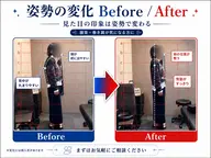 【姿勢改善整体】猫背、反り腰が気になる方におすすめ！✨
