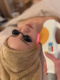 【女性】［美肌・美白効果抜群！]全顔美肌脱毛　ハリ・ツヤUP♪