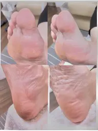 4月限定「フットケアコース(足裏角質ケア付)¥5980」