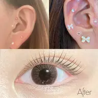 耳つぼジュエリー両耳10粒