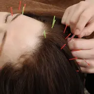 💤快眠💤頭皮鍼＋パルス(電気鍼)ヘッドスパ、ヘッドマッサージ