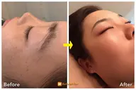 まゆげワックス（ワックス脱毛）　｜眉毛の黄金比測りまゆWax脱毛します。細かい毛はツイーザーや剃刀でも処理