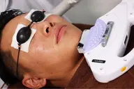 ヒゲ脱毛体験✨