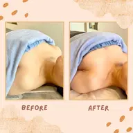 本気でバストアップケア！💓ボンボンバスト💓