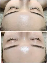 【ハーブピーリング】たっぷり2g《 REVI 陶肌トリートメント》剥離なし!次世代ハーブピーリング