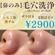 【🍓👃🏻いちご鼻卒業👃🏻🍓】徹底毛穴ケア!!鼻のみ毛穴洗浄×毛穴引き締めパック🧴