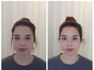 顔の歪み+小顔整体、骨盤調整【50分15200円→3500円】