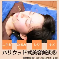 【新規限定】肌質改善★美容鍼灸(60分コース)