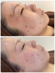 【新規】肌コンディションを整えたい方へ✨やさしい肌ケア体験(カウンセリング付)