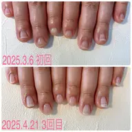 【爪育成３回分🫶うる艶クリアジェル】割やすい.折れる.ピンク育てたい方におすすめ☺︎🉐最強オイル♡甘皮ごっそりケア付