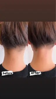 シュガーリングワックス🍯うなじ脱毛