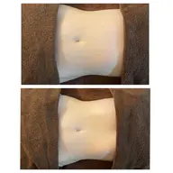 腸ドレナージュ