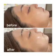 【本格美白✨】憧れ美白しっとり肌🌹陶肌トリートメント＋シルクオプション🌹