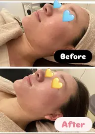 大人気💗どこのサロンよりお得✨小顔フェイシャルマッサージ40分＋痩身ボディートリートメント40分の全身80分￥6600