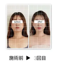 小顔矯正×フットケア(骨盤ケア) 【顔のたるみ、食いしばり、足のむくみが気になる方に】