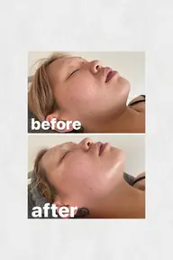 小顔フェイシャル+部分ケア