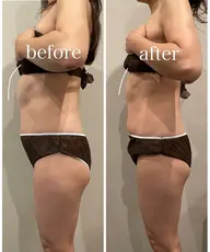 計120分　［ストレスフルな方へ］腸タイプカウンセリング30分＋オーダーメイド腸もみ90分