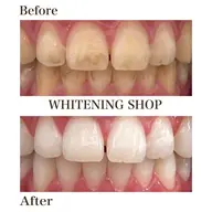 2回目以降都度払いの方【¥8,980】40分照射✨