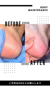 【極上フット角質ケア】