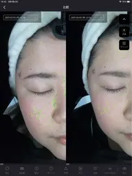 お肌占い(フェイシャルエステ付き)