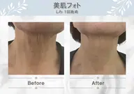 ✨美肌フォト✨首🦋