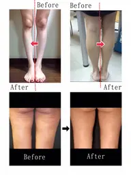 【特別価格】当店人気No1の下半身痩身✨ 【最大３回まで同価格で繰り返し利用可能】※数量限定