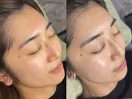 続けやすい肌育【フェイスワックス×ハーブピーリング】くすみ/毛穴退治☆ハリつや感アップ