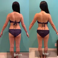 【EMS1ヶ月通い放題🔥】本気の人向け★全身に20パット装着で全身痩せ！ 20分　￥29,800