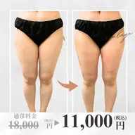 【大人気平日限定★全身１部位】《大型2カップ》冷却＋痩身マッサージ