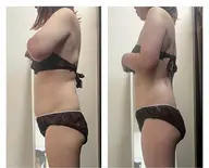 《痩身人気No.1》全身ハイパーナイフ+強力デトックスマッサージ🔥