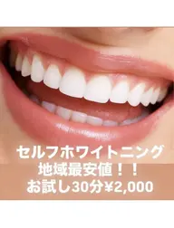 【清潔感up.ᐟ】 セルフホワイトニング 30分 《予約リクエストのみ》