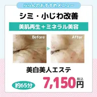 👑おまかせセット💞【美白美人エステ】